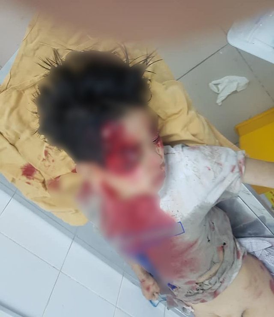 Nghi án ô tô kéo lê bé trai hơn 100m: Tài xế đến trình diện công an - 1 Nghi án ô tô kéo lê bé trai hơn 100m: Tài xế đến trình diện công an - 1