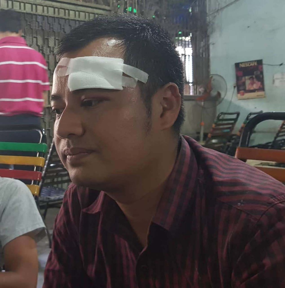 Đòi nợ, phó giám đốc bị 10 giang hồ vây đánh chảy máu đầu Đòi nợ, phó giám đốc bị 10 giang hồ vây đánh chảy máu đầu