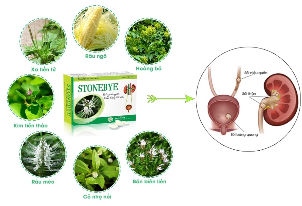 Sỏi bàng quang nên mổ hay chữa bằng thuốc nam? – Cách trị nào tốt nhất? - 2 Sỏi bàng quang nên mổ hay chữa bằng thuốc nam? – Cách trị nào tốt nhất? - 2