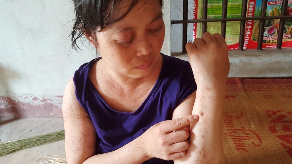 Người đàn bà khốn khổ ở viện nhiều hơn ở nhà vì mắc bệnh hiểm - 3 Người đàn bà khốn khổ ở viện nhiều hơn ở nhà vì mắc bệnh hiểm - 3