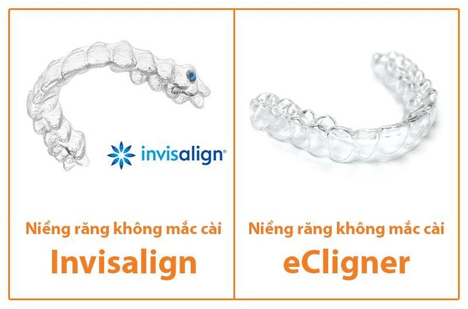 Niềng răng trong suốt: Tiền mất mà răng vẫn xấu, vì sao? - 2