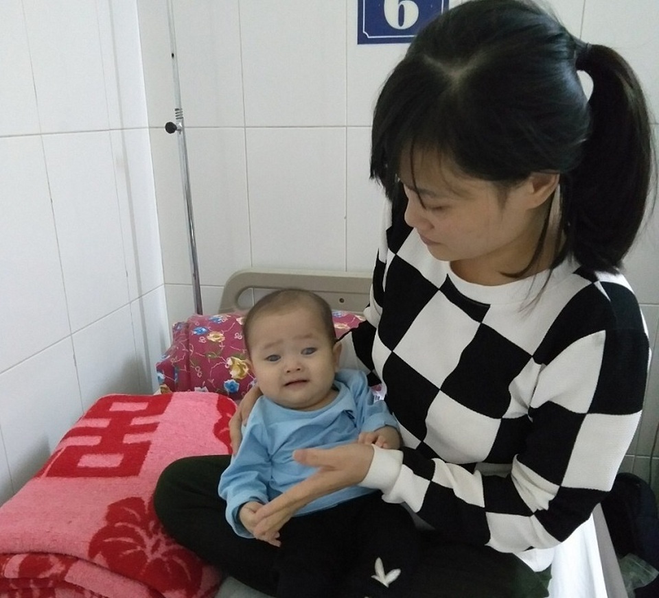 Mắc bệnh hiếm gặp, bé 1 tuổi nguy cơ mù vĩnh viễn vì... không đủ tiền phẫu thuật - 3 Mắc bệnh hiếm gặp, bé 1 tuổi nguy cơ mù vĩnh viễn vì... không đủ tiền phẫu thuật - 3