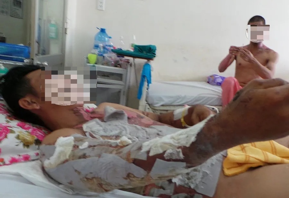 Bỏng nặng vì “tắm” bằng hóa chất thông cống - 1