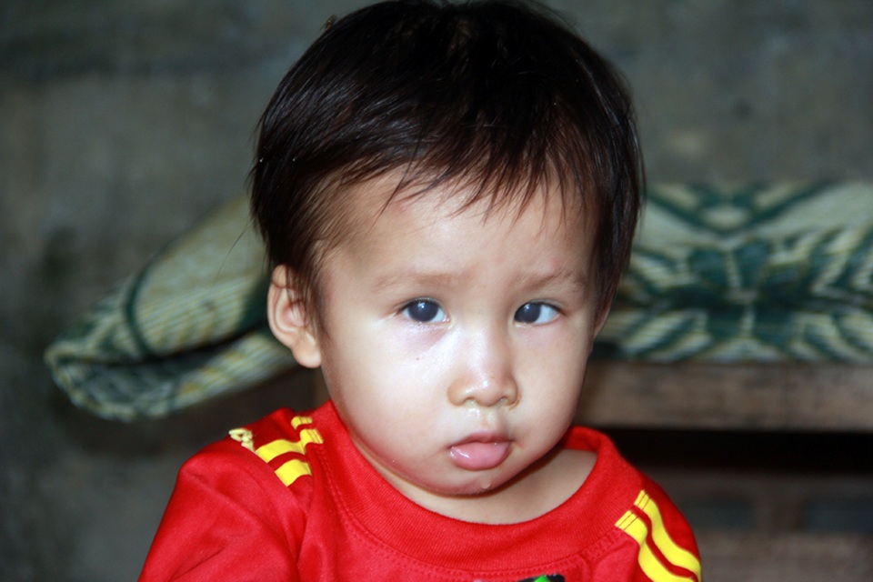 Tuổi thơ không lành lặn của 2 bé miền quê nghèo Hà tĩnh, nguy cơ mù vĩnh viễn - 6 Tuổi thơ không lành lặn của 2 bé miền quê nghèo Hà tĩnh, nguy cơ mù vĩnh viễn - 6
