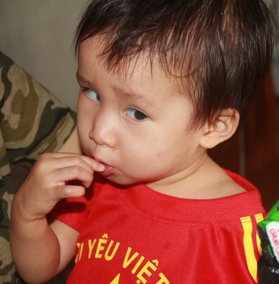 Tuổi thơ không lành lặn của 2 bé miền quê nghèo Hà tĩnh, nguy cơ mù vĩnh viễn - 5 Tuổi thơ không lành lặn của 2 bé miền quê nghèo Hà tĩnh, nguy cơ mù vĩnh viễn - 5