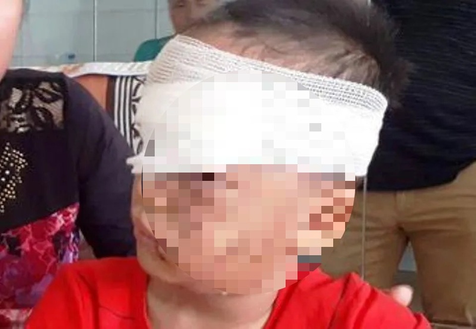 Bé trai 12 tuổi bị chó tấn công vào đầu, tai chấn thương nặng - 1 Bé trai 12 tuổi bị chó tấn công vào đầu, tai chấn thương nặng - 1