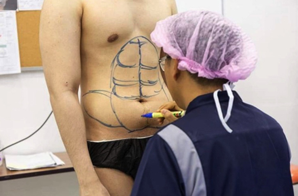 Dịch vụ phẫu thuật cơ bụng 6 múi lên ngôi - 1