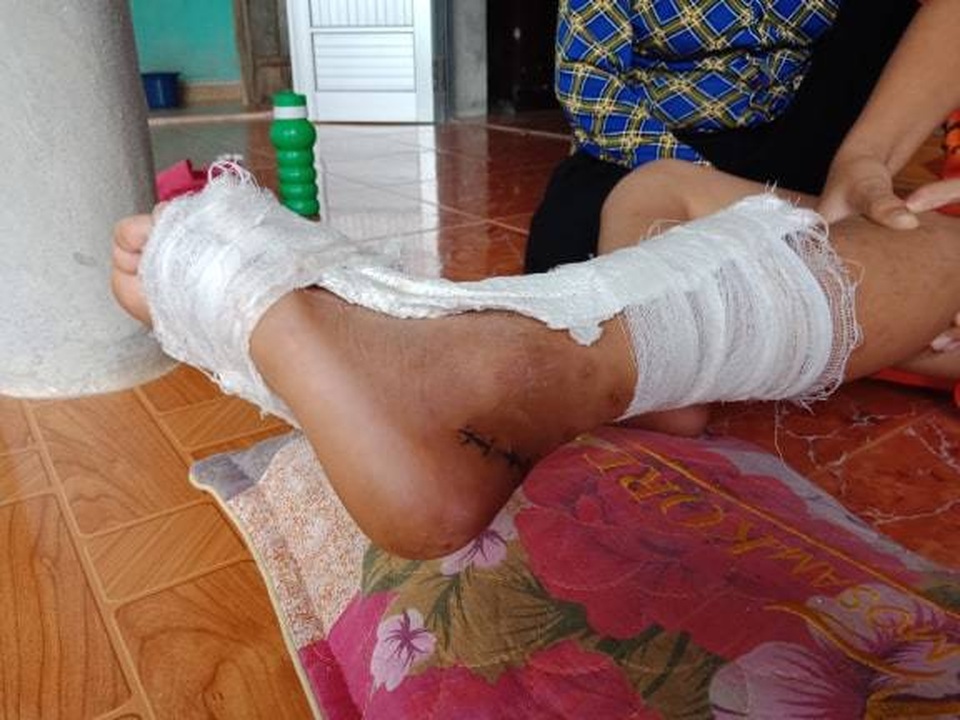 Học sinh bị đứt gân trong giờ học, hiệu trưởng nói “Chuyện có gì lớn mà làm ầm lên” - 2 Học sinh bị đứt gân trong giờ học, hiệu trưởng nói “Chuyện có gì lớn mà làm ầm lên” - 2