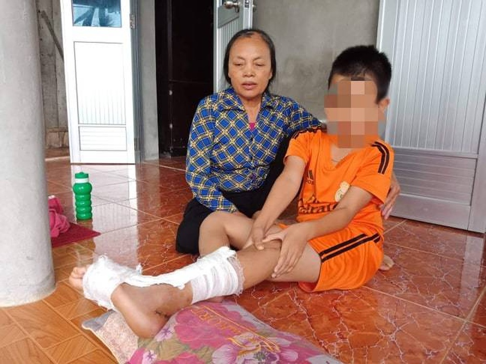 Học sinh bị đứt gân trong giờ học, hiệu trưởng nói “Chuyện có gì lớn mà làm ầm lên” - 1 Học sinh bị đứt gân trong giờ học, hiệu trưởng nói “Chuyện có gì lớn mà làm ầm lên” - 1