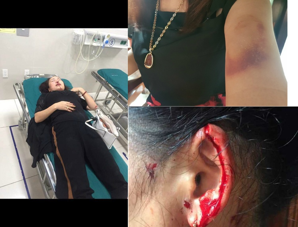 Vụ nữ giám đốc tố liên tục bị truy sát: Công an thu giữ 4 viên đạn - 1 Vụ nữ giám đốc tố liên tục bị truy sát: Công an thu giữ 4 viên đạn - 1