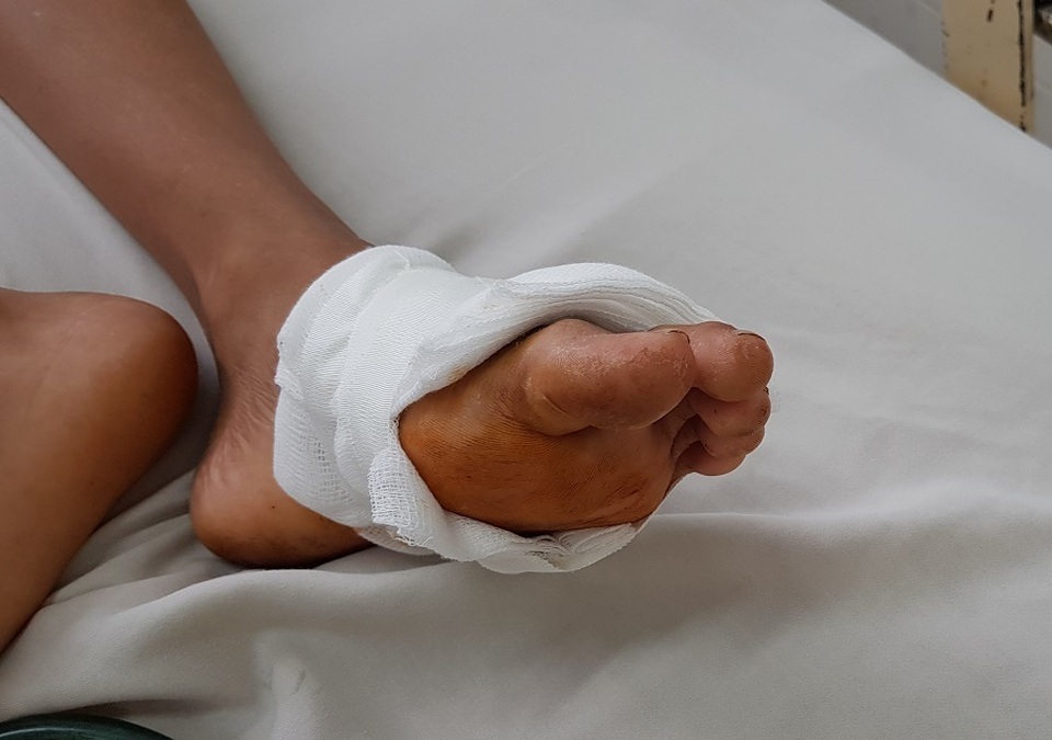 Xót xa cậu học trò nghèo bị nhiễm uốn ván trong lúc đi lượm ve chai - 2 Xót xa cậu học trò nghèo bị nhiễm uốn ván trong lúc đi lượm ve chai - 2