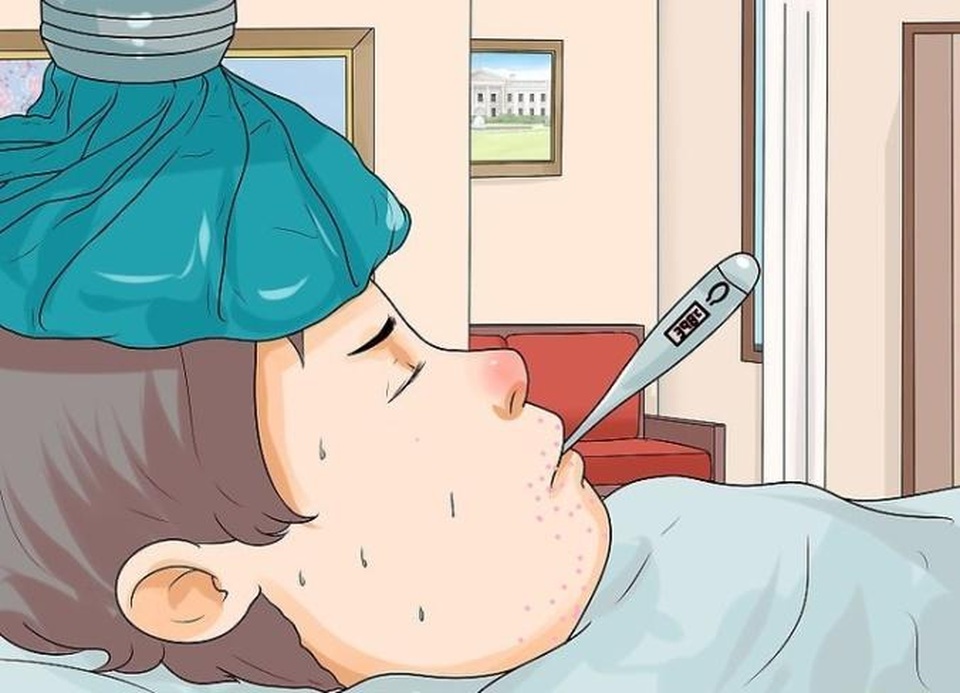 Cách nhận biết biểu hiện bệnh tay chân miệng - 2 Cách nhận biết biểu hiện bệnh tay chân miệng - 2