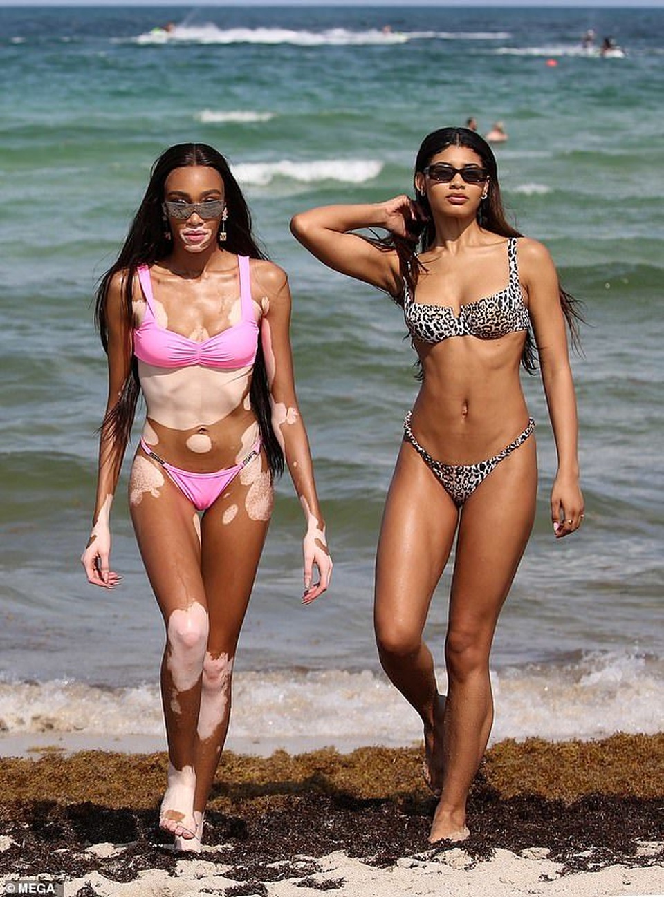 Winnie Harlow khoe dáng săn chắc và thanh mảnh - 2 Winnie Harlow khoe dáng săn chắc và thanh mảnh - 2