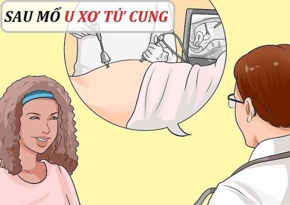 Sau mổ u xơ tử cung cần lưu ý gì? - 1 Sau mổ u xơ tử cung cần lưu ý gì? - 1