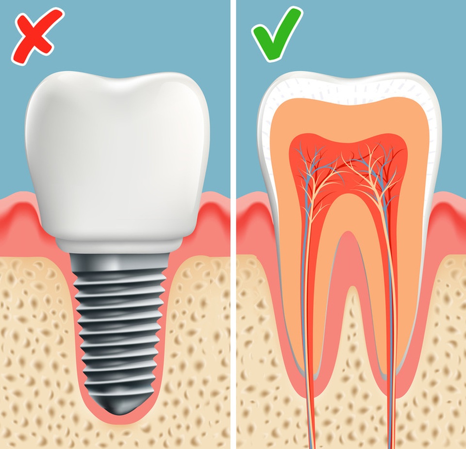 Công nghệ khiến răng tự mọc lại sau khi rụng: Sẽ không còn ai phải trồng răng! - 5