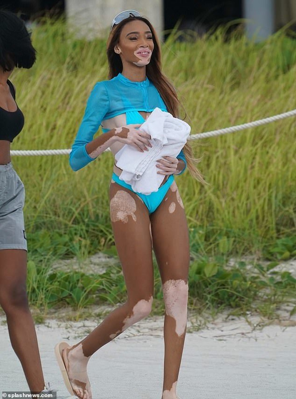 Chân dài bạch biến Winnie Harlow sải bước quyến rũ trên biển - 10 Chân dài bạch biến Winnie Harlow sải bước quyến rũ trên biển - 10