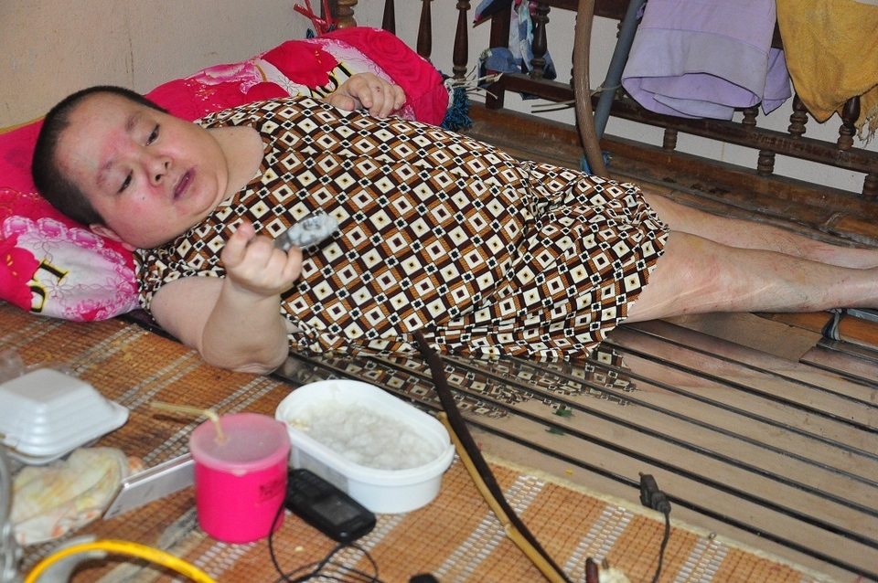 Rớt nước mắt cảnh “người cá” vượt trăm cây số nương nhờ em gái bát cháo qua ngày - 1 Rớt nước mắt cảnh “người cá” vượt trăm cây số nương nhờ em gái bát cháo qua ngày - 1