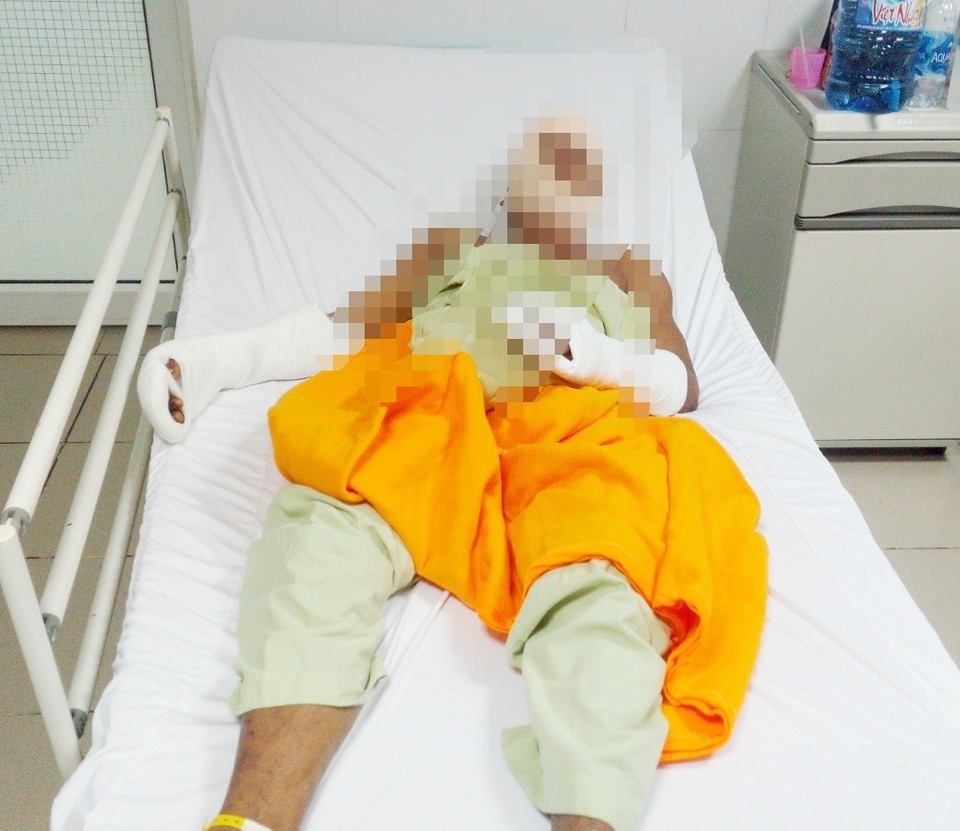 Đang đãi tiệc cưới, cô dâu bị chồng cũ xông vào chém - 2 Đang đãi tiệc cưới, cô dâu bị chồng cũ xông vào chém - 2