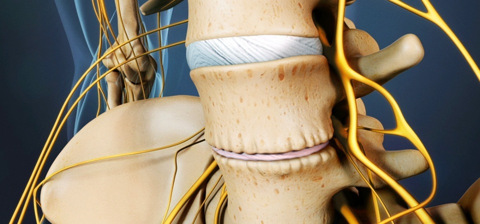 Cải thiện bệnh gai cột sống bằng cách cực kỳ đơn giản - 1