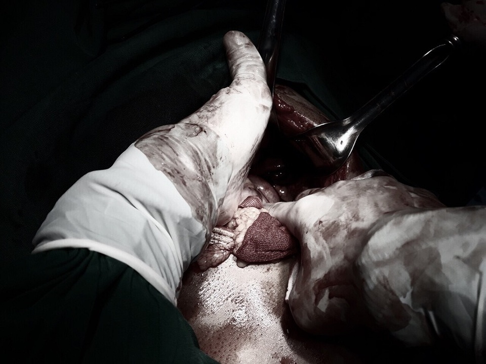 Chủ quan sau tai nạn, nam thanh niên suýt mất mạng - 1