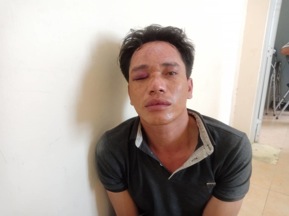 Băng trộm vu công an là cướp để tung hỏa mù - 1