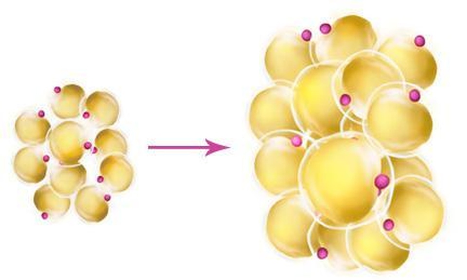 Bạn có biết: Khối u bướu hình thành qua những bước nào? - 3