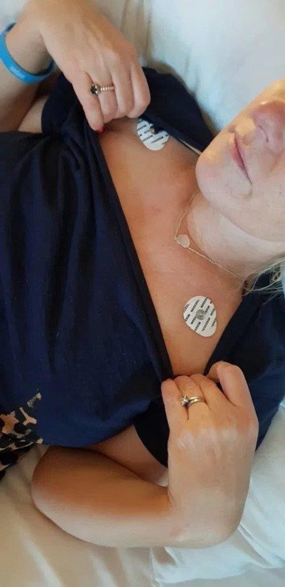 Ngộ độc liệt giường vì ăn phải suất ăn bị mốc trên máy bay - 2