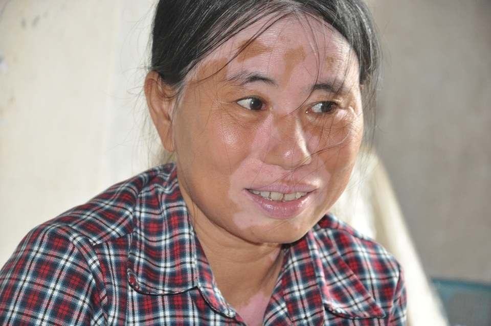 Khuôn mặt lạ của chị Đặm điếc rạng ngời khi được bạn đọc Dân trí quan tâm giúp đỡ hơn 50 triệu đồng - 5 Khuôn mặt lạ của chị Đặm điếc rạng ngời khi được bạn đọc Dân trí quan tâm giúp đỡ hơn 50 triệu đồng - 5