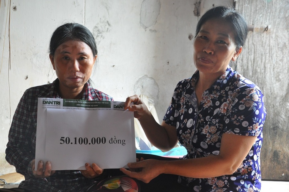 Khuôn mặt lạ của chị Đặm điếc rạng ngời khi được bạn đọc Dân trí quan tâm giúp đỡ hơn 50 triệu đồng - 6 Khuôn mặt lạ của chị Đặm điếc rạng ngời khi được bạn đọc Dân trí quan tâm giúp đỡ hơn 50 triệu đồng - 6