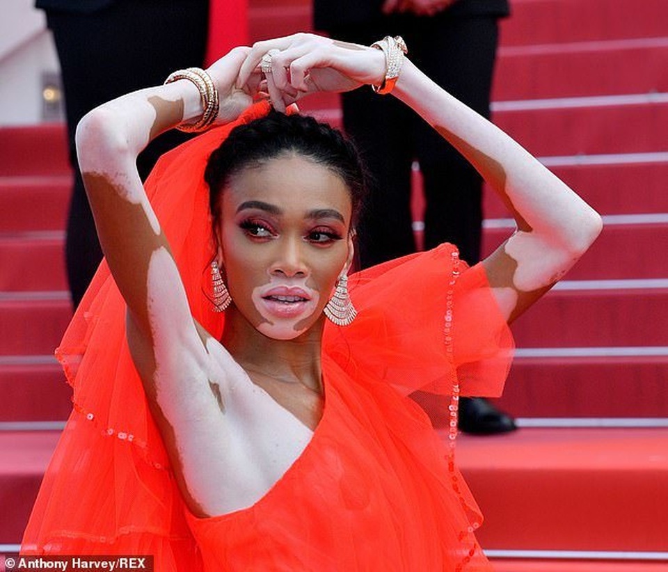 Winnie Harlow gặp sự cố trên thảm đỏ Cannes vì váy quá ngắn - 3 Winnie Harlow gặp sự cố trên thảm đỏ Cannes vì váy quá ngắn - 3