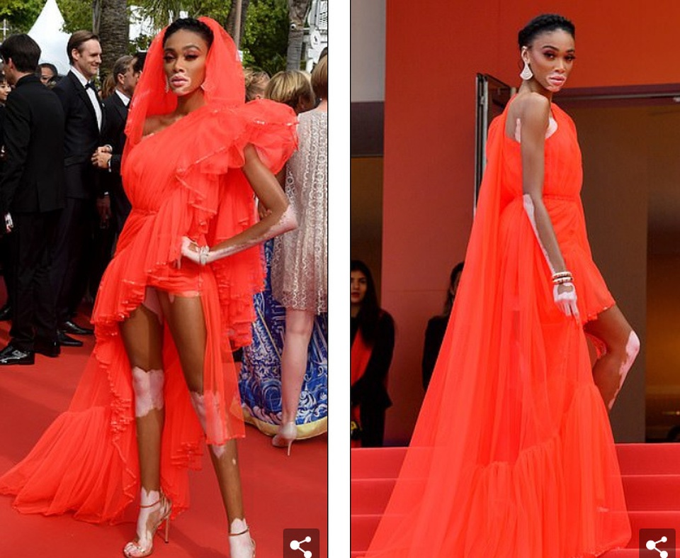 Winnie Harlow gặp sự cố trên thảm đỏ Cannes vì váy quá ngắn - 5 Winnie Harlow gặp sự cố trên thảm đỏ Cannes vì váy quá ngắn - 5