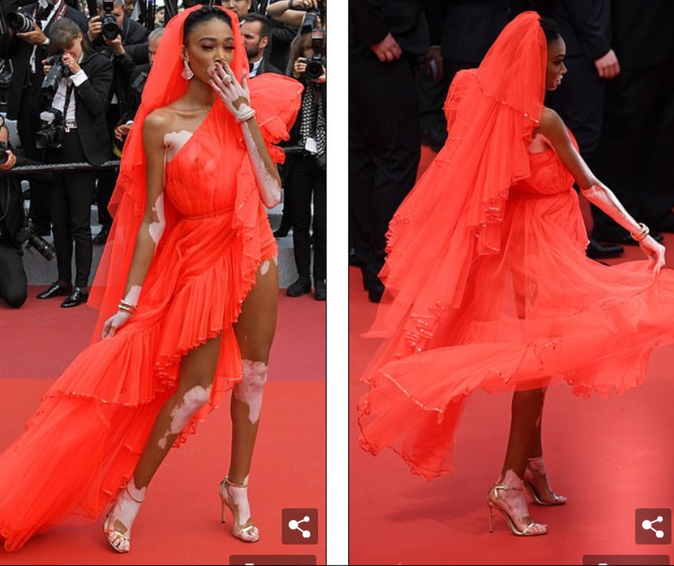 Winnie Harlow gặp sự cố trên thảm đỏ Cannes vì váy quá ngắn - 7 Winnie Harlow gặp sự cố trên thảm đỏ Cannes vì váy quá ngắn - 7