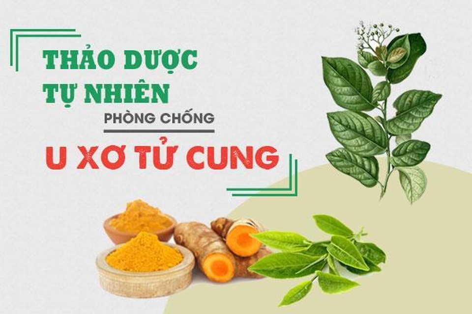 U xơ tử cung và giải pháp hỗ trợ điều trị hiệu quả - 1 U xơ tử cung và giải pháp hỗ trợ điều trị hiệu quả - 1