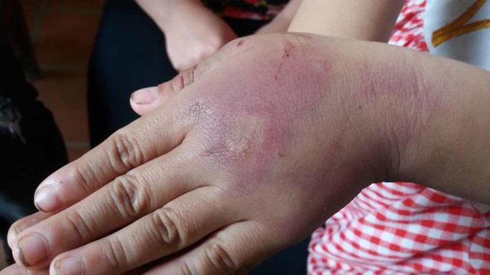 Bố mẹ giáo dục con bằng đòn roi, hãy coi chừng bị xử tù như chơi! - 1 Bố mẹ giáo dục con bằng đòn roi, hãy coi chừng bị xử tù như chơi! - 1