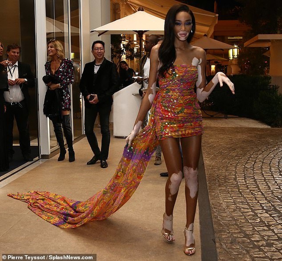 Mê mẩn đôi chân dài miên man của 2 siêu mẫu - 5