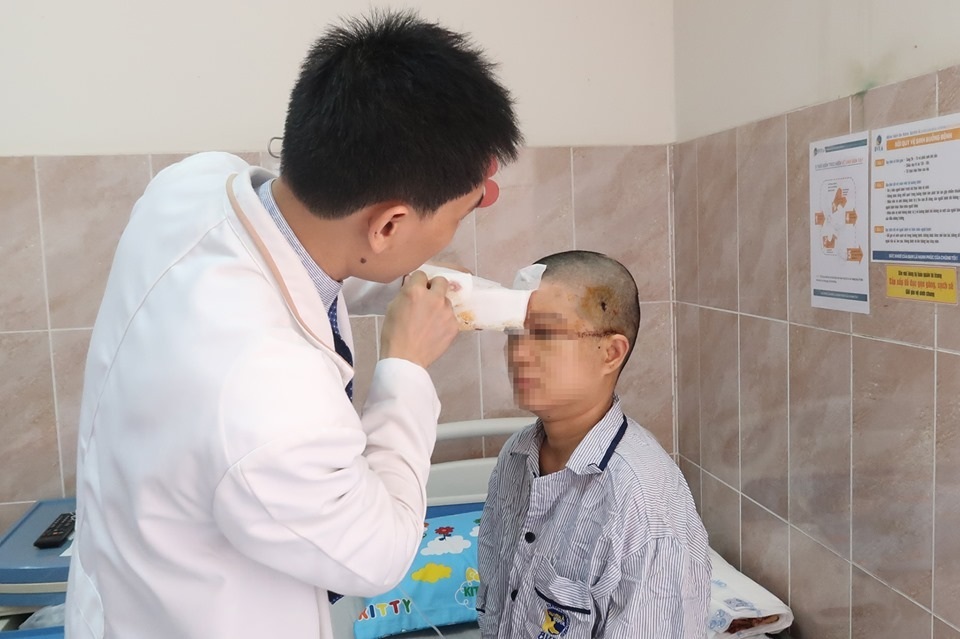 Bị máy dệt lột hết da đầu nạn nhân còn trơ hộp sọ - 1 Bị máy dệt lột hết da đầu nạn nhân còn trơ hộp sọ - 1
