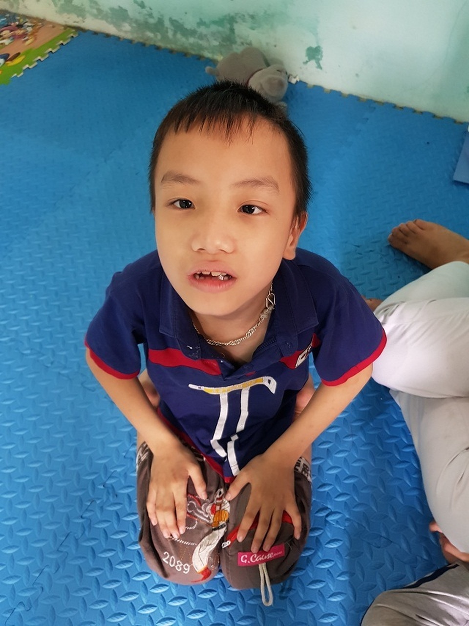 Nghẹn lòng người mẹ trẻ ôm 2 con song sinh bại não trong ngôi nhà trọ - 18 Nghẹn lòng người mẹ trẻ ôm 2 con song sinh bại não trong ngôi nhà trọ - 18