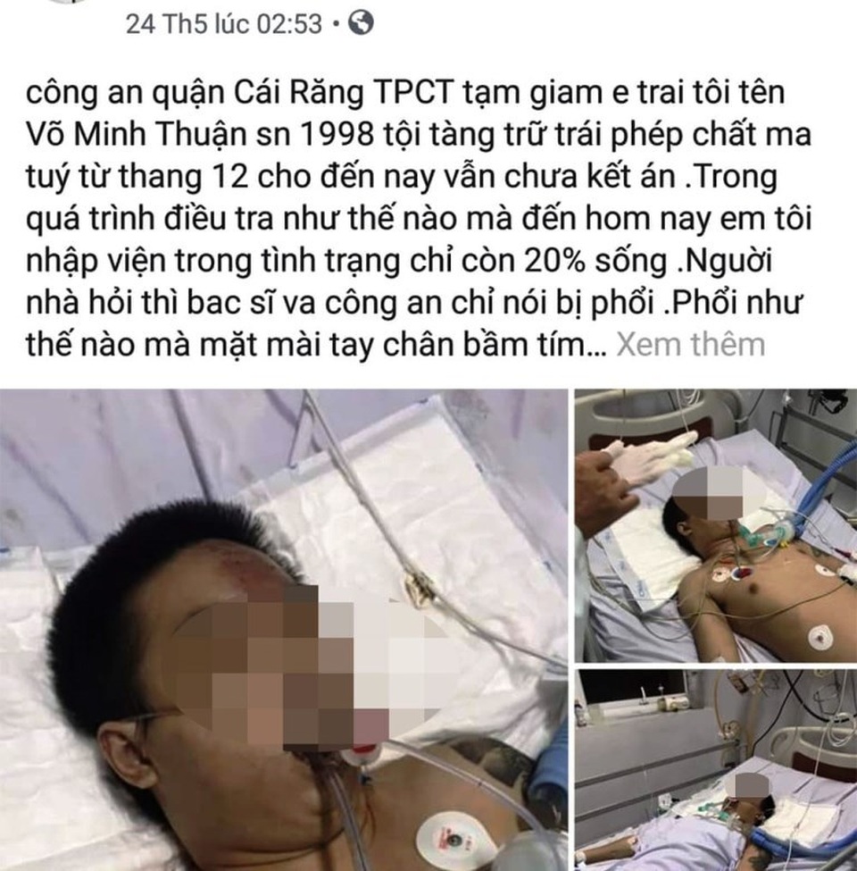 Làm rõ thông tin bị can tạm giam bị ngã đến nhập viện - 1 Làm rõ thông tin bị can tạm giam bị ngã đến nhập viện - 1