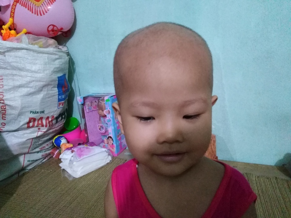 Xót xa bé gái 3 tuổi đã phải chống chọi bệnh ung thư máu - 4 Xót xa bé gái 3 tuổi đã phải chống chọi bệnh ung thư máu - 4