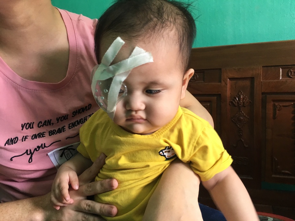 Bạn đọc Dân trí giúp đỡ cô bé 1 tuổi hơn 107 triệu đồng sang Singgapore chữa mắt - 2