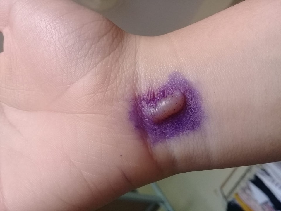 Kiến ba khoang tấn công, người Sài Gòn “mất ăn mất ngủ” - 7