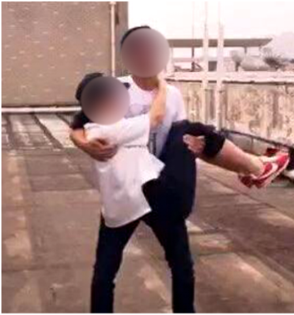 Gãy xương cánh tay, trật khớp khuỷu tay vì bế... bạn gái - 1 Gãy xương cánh tay, trật khớp khuỷu tay vì bế... bạn gái - 1