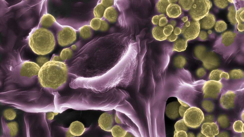 Phát hiện mới: Loài nấm “đại gia” thích đào vàng và đeo vàng lên người - 2