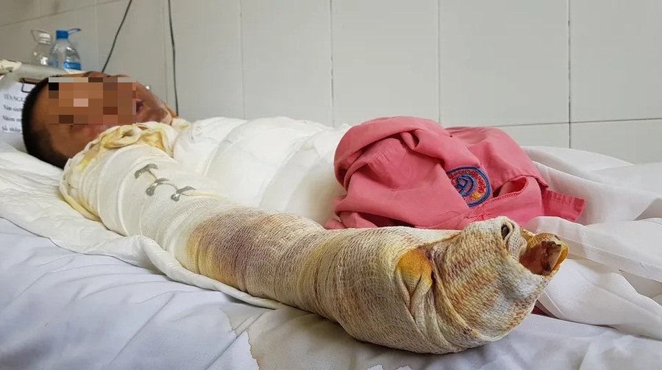 Ớn lạnh những vụ dùng xăng để giải quyết ân oán tình cảm! - 2 Ớn lạnh những vụ dùng xăng để giải quyết ân oán tình cảm! - 2