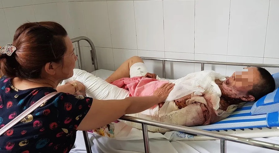 Ớn lạnh những vụ dùng xăng để giải quyết ân oán tình cảm! - 5 Ớn lạnh những vụ dùng xăng để giải quyết ân oán tình cảm! - 5