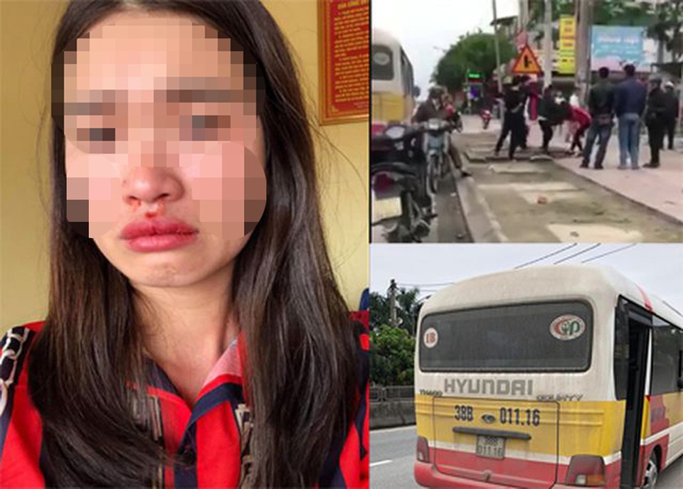 Vụ “nhà xe đầu gấu” đánh nữ hành khách: Đình chỉ vụ án vì người bị hại rút đơn - 1 Vụ “nhà xe đầu gấu” đánh nữ hành khách: Đình chỉ vụ án vì người bị hại rút đơn - 1