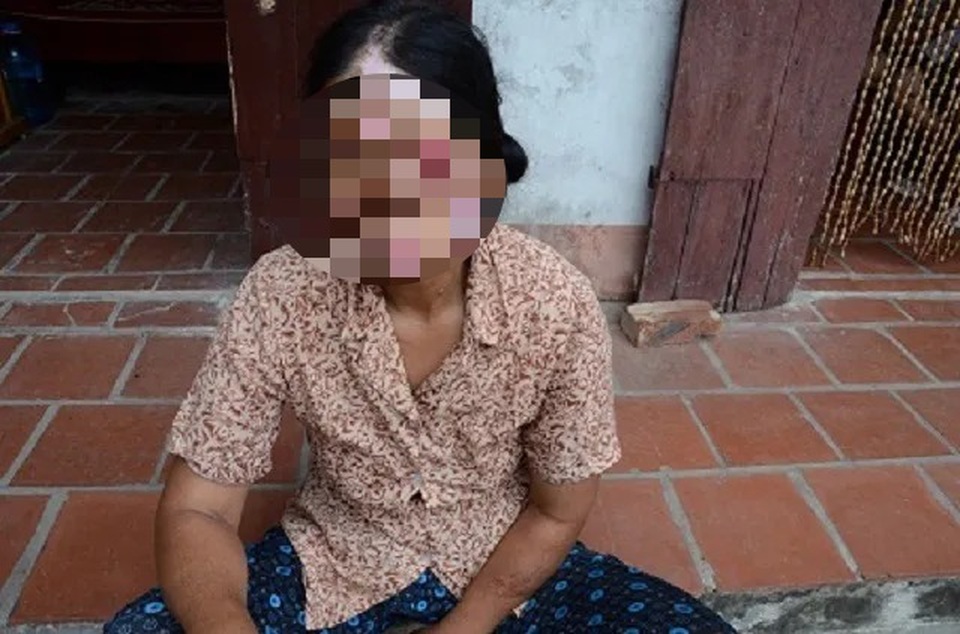 Xót xa chàng thanh niên bị suy thận vẫn cố sống lo cho người mẹ bệnh động kinh - 1 Xót xa chàng thanh niên bị suy thận vẫn cố sống lo cho người mẹ bệnh động kinh - 1