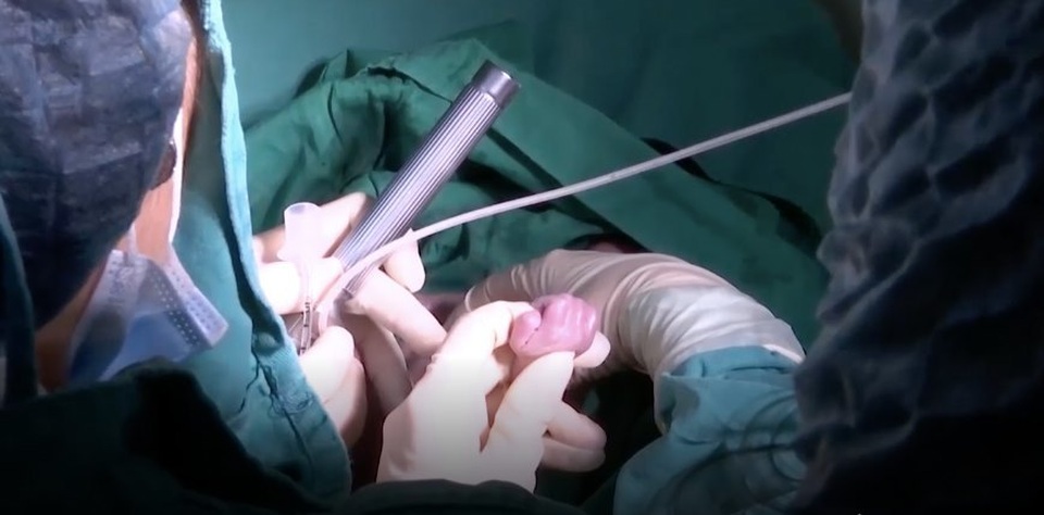 Mỗi ngày người mẹ ung thư vú giai đoạn cuối đều được nhìn video con oe khóc - 2 Mỗi ngày người mẹ ung thư vú giai đoạn cuối đều được nhìn video con oe khóc - 2