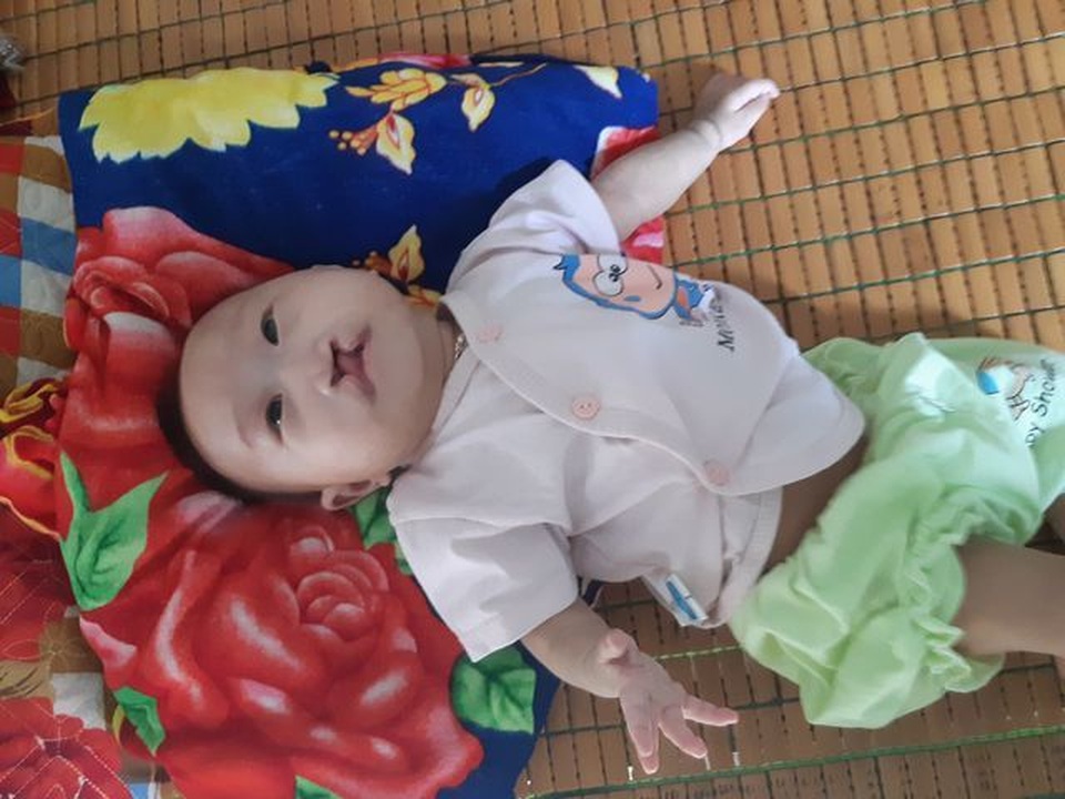 Bạn đọc giúp đỡ hơn 30 triệu đồng bé gái bị tim bẩm sinh, hở hàm ếch - 3 Bạn đọc giúp đỡ hơn 30 triệu đồng bé gái bị tim bẩm sinh, hở hàm ếch - 3