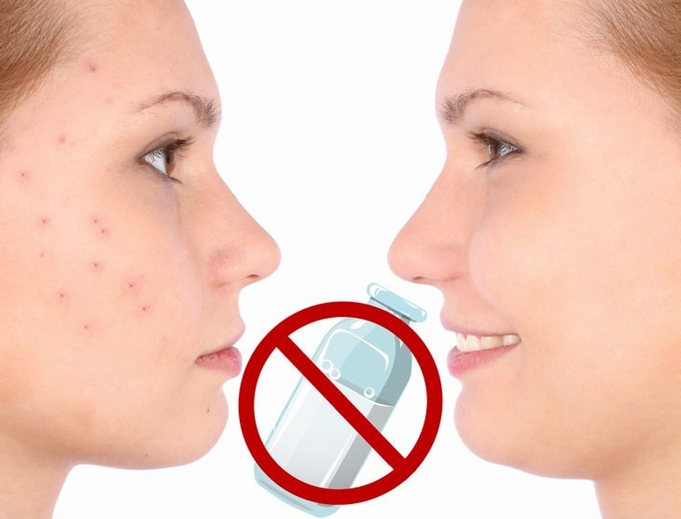 Ai là người tuyệt đối không nên uống sữa bò? - 4 Ai là người tuyệt đối không nên uống sữa bò? - 4